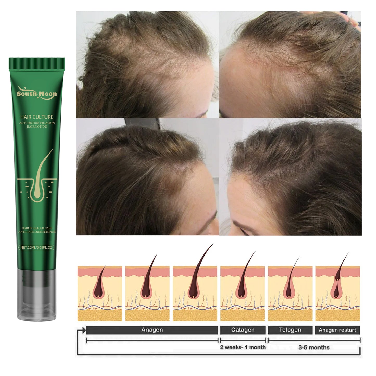 Scalp Essence Ginger Gently Moisturizes And Moisturizes Dry And Dry Hair - E-Esther Clothing Store